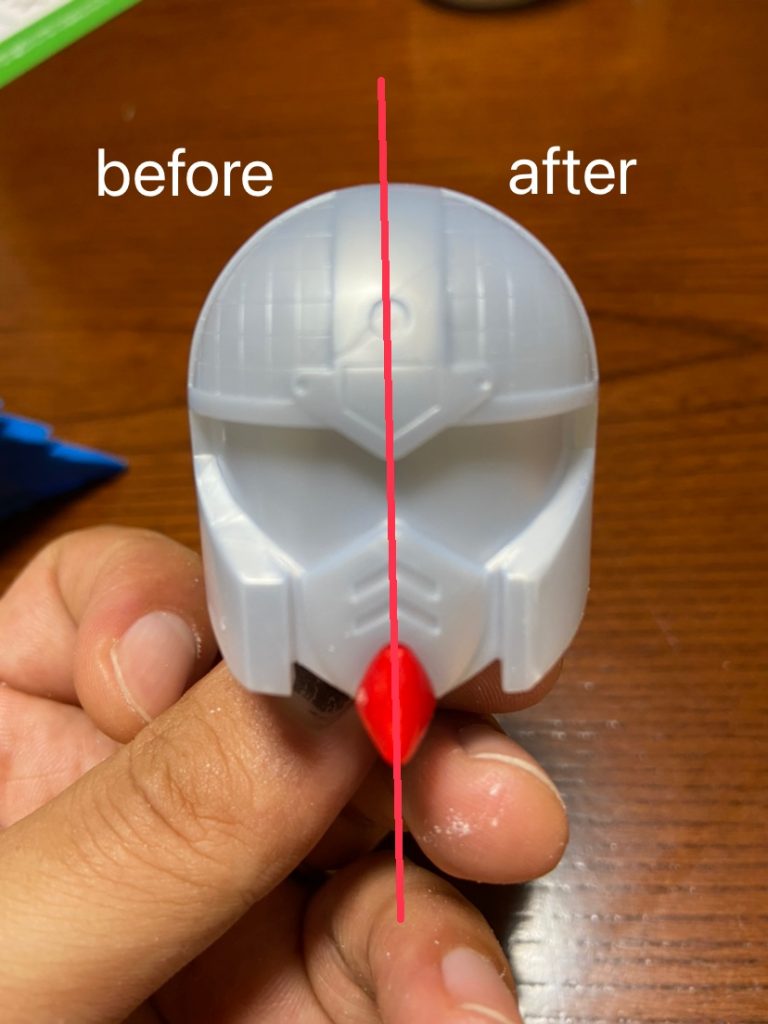 まずふとましいお顔が残念なので整形✨