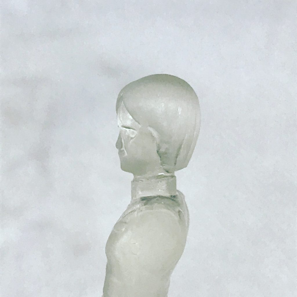 うわさ通り、あごというか、下唇がかなり出ていましたので、シュッとなるように削りました。