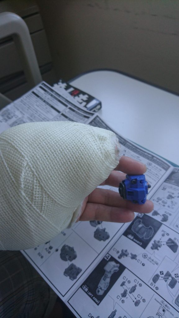手の痛みで、涙を流しながら病室のベットで、ガンプラを作っている所。
