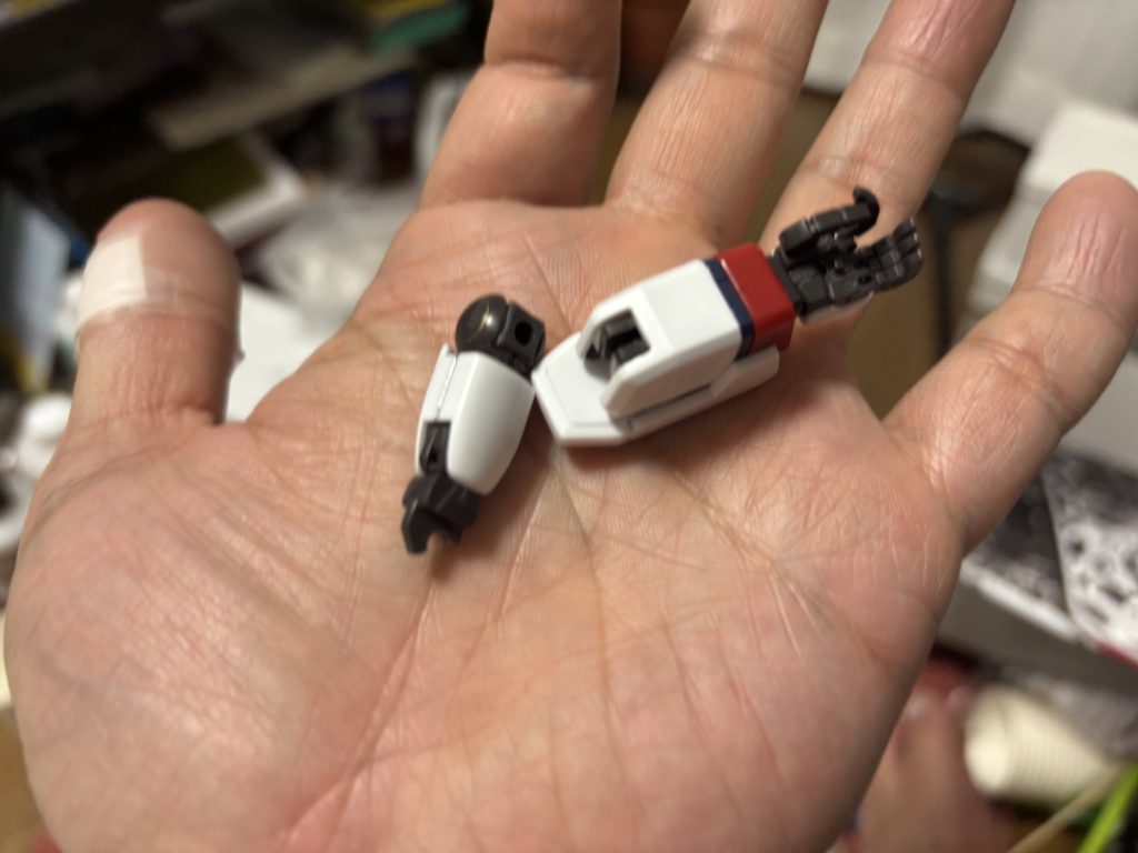 腕関節が折れた時…ほんと心も折れそうよ…